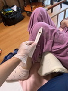 治療の効果をわかりやすく数値化