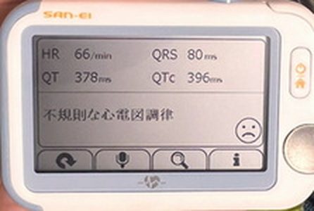 心臓リハビリ